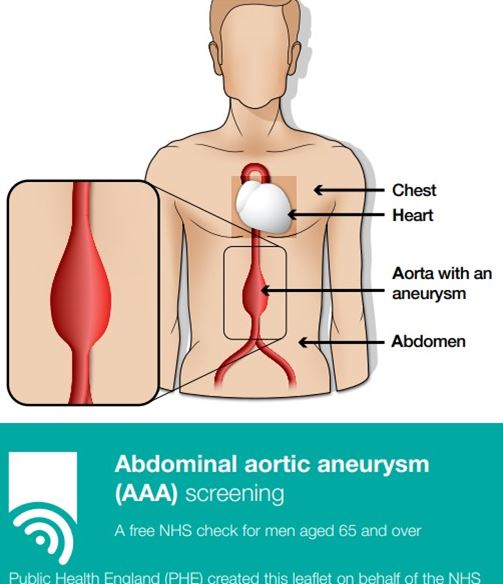 AAA